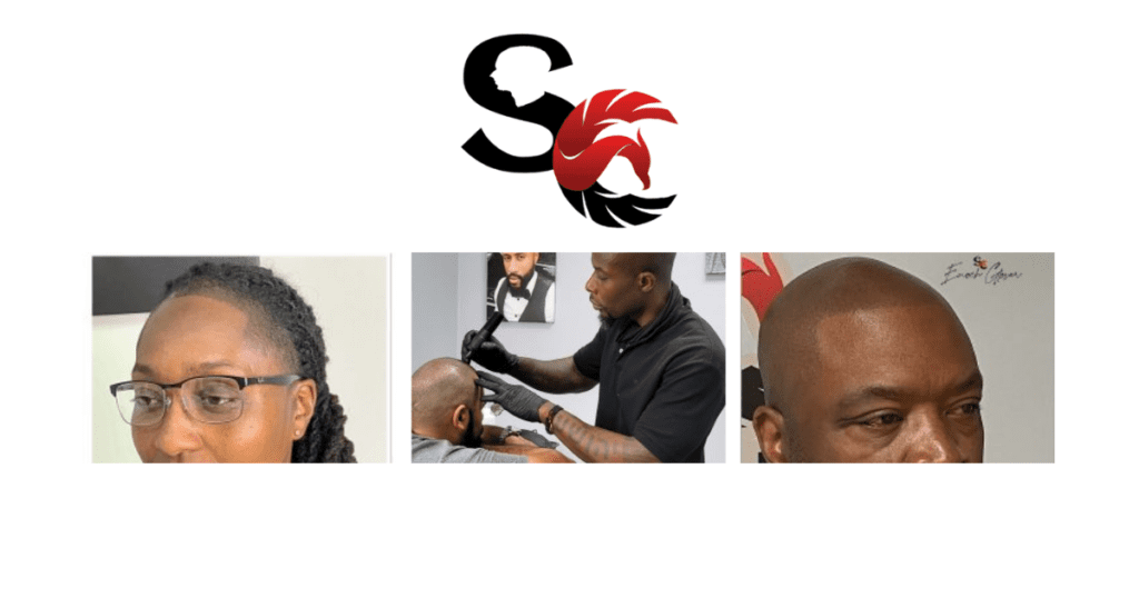Scalp Carolinas